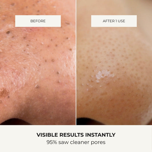 Ultrasonic Glow Wand™